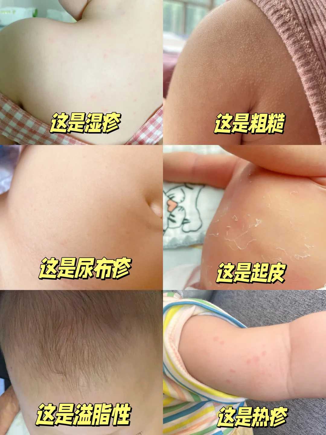 深圳供卵试管医院最好的,深圳助孕生子-深圳辅助生殖中心